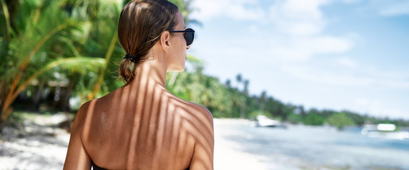 First Aid for Sunburn: Soothing Your Skin